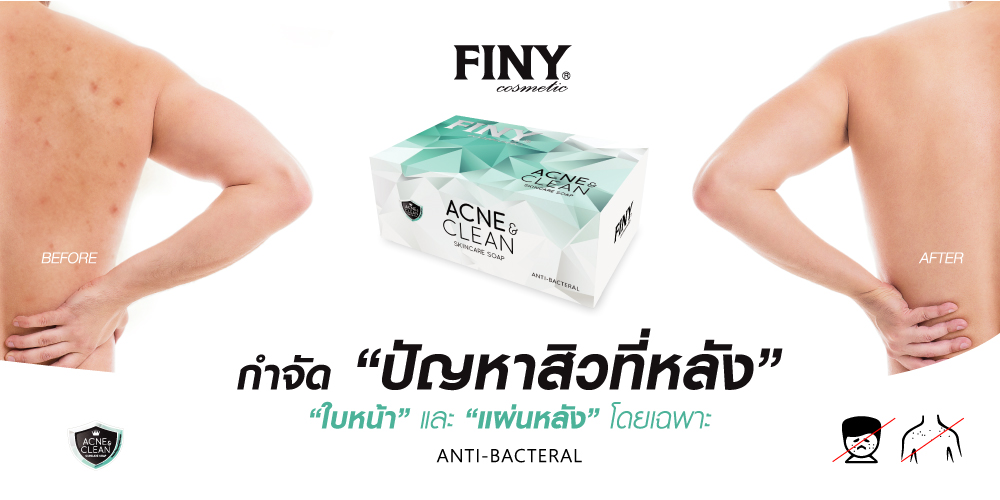 สบู่รักษาสิว,สบู่ผิวขาว,ฟินนี่,สบู่ฟินนี่